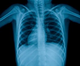 Tuberculosis at Public Schools: Symptoms and Precautions