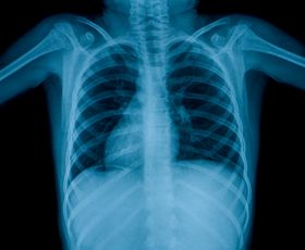Tuberculosis at Public Schools: Symptoms and Precautions
