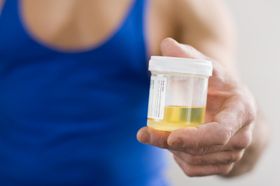 Should Schools Perform Drug Tests on Students?